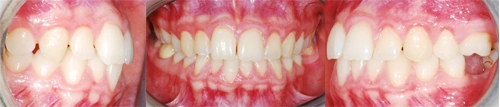 ортодонтия
